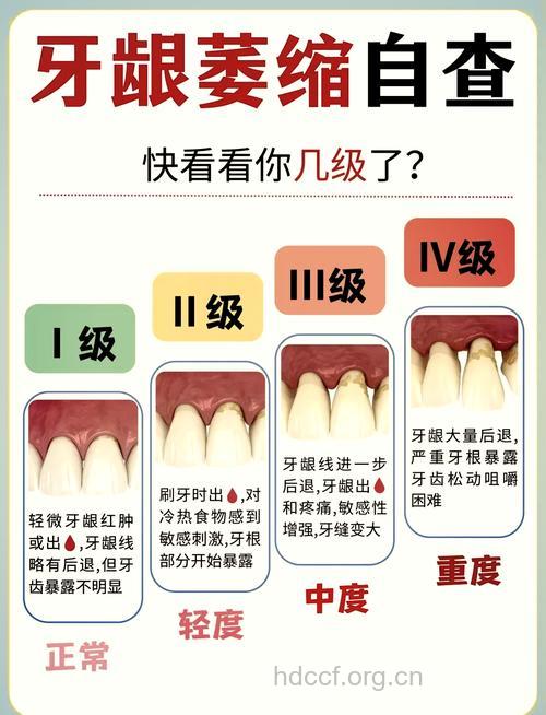 引起牙槽骨萎缩的原因