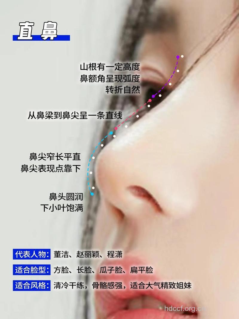 长鼻整形术的常识
