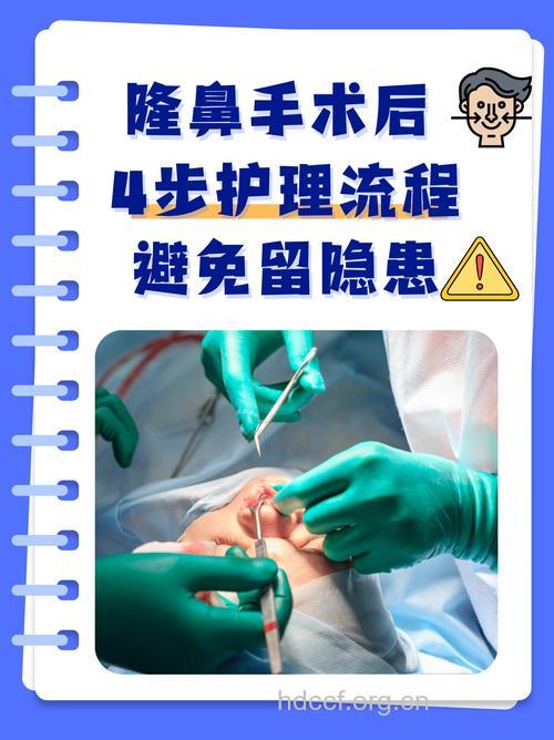 隆鼻手术的术后护理