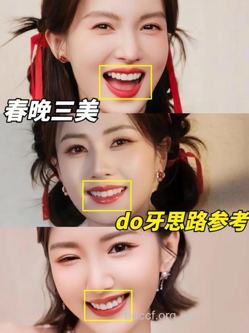 明星牙齿整形的秘密