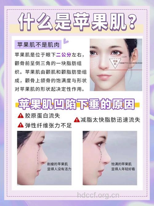 苹果肌丰颊手术有哪些作用
