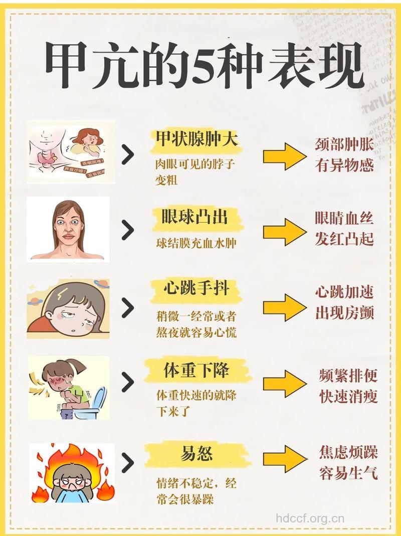 疾病百科 甲亢都有哪些表现呢