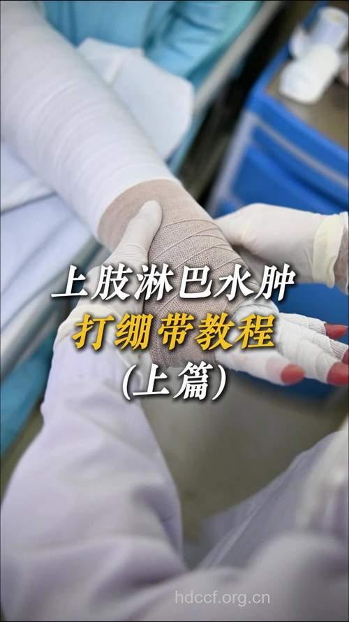 淋巴水肿如何进行心理护理