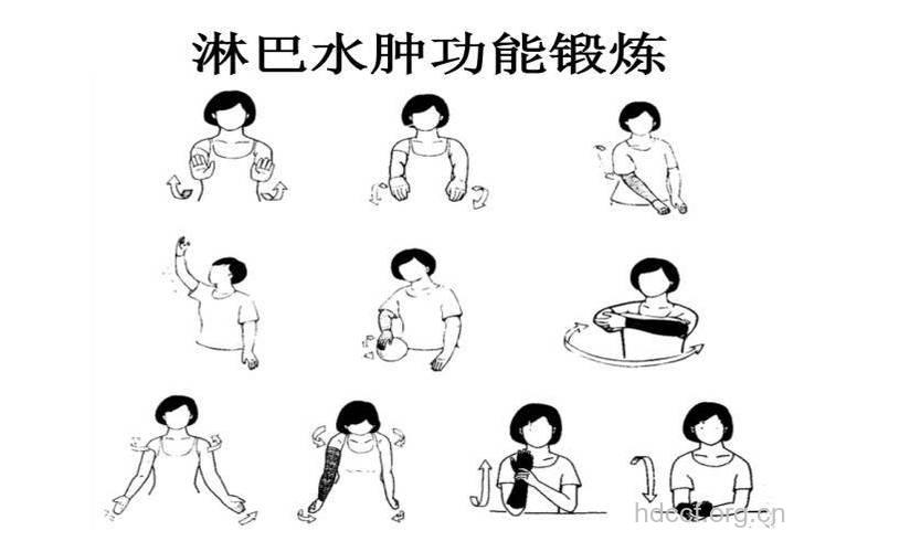 如何减轻上肢淋巴水肿