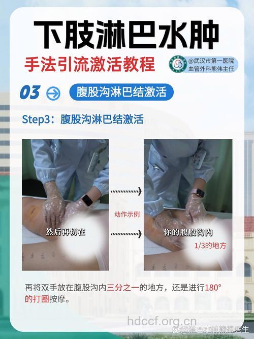 下肢淋巴水肿有什么护理方法