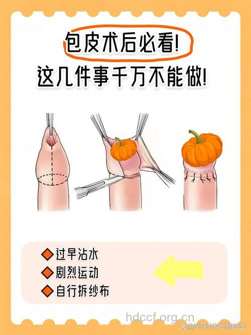 做阴茎再造手术要注意些什么