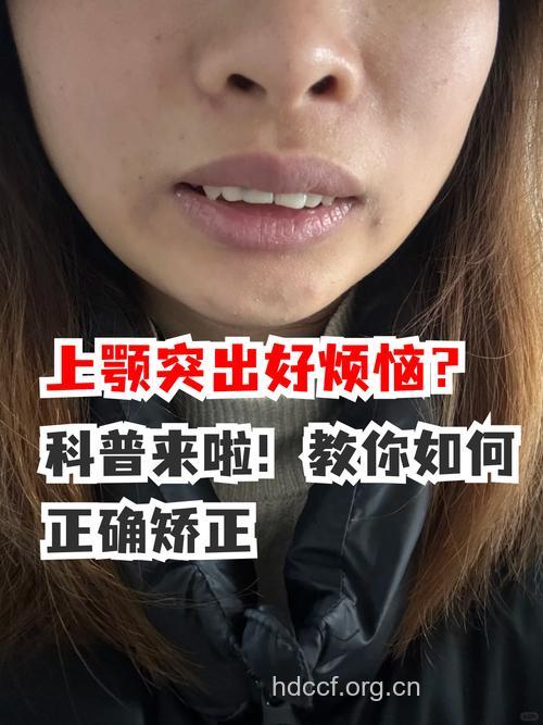 下巴过于突出要怎么办