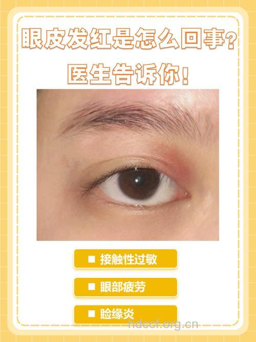 春季清爽苗条你眼红了吗