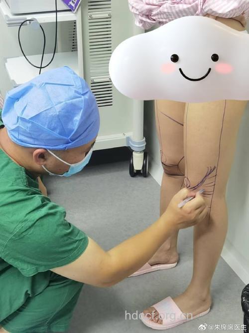 怎么进行腿部吸脂手术方法