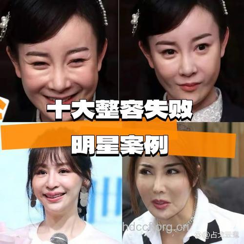 女星为什么会＂被整容＂