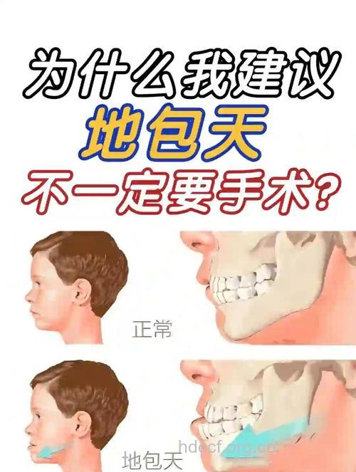 牙齿“地包天”要怎么办