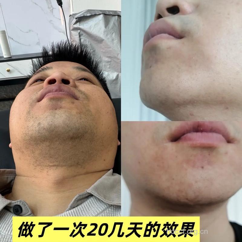 男人为什么不能用手拔胡须