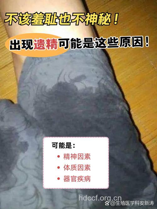 哪些因素导致男性频繁遗精