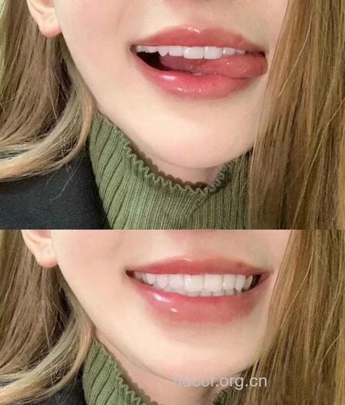 什么样的牙齿才是最美丽呢