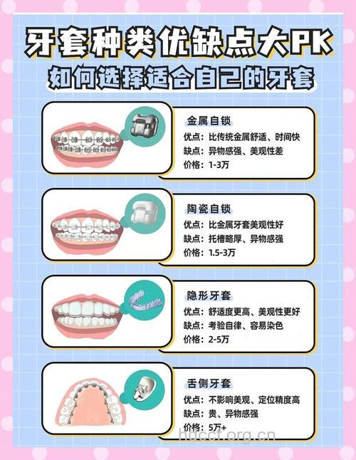 牙齿矫正有哪些方式