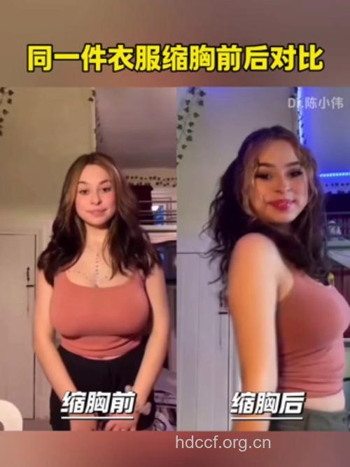 隆胸手术前后有哪些常见问题