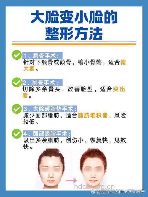 面部整形有哪些手术方法