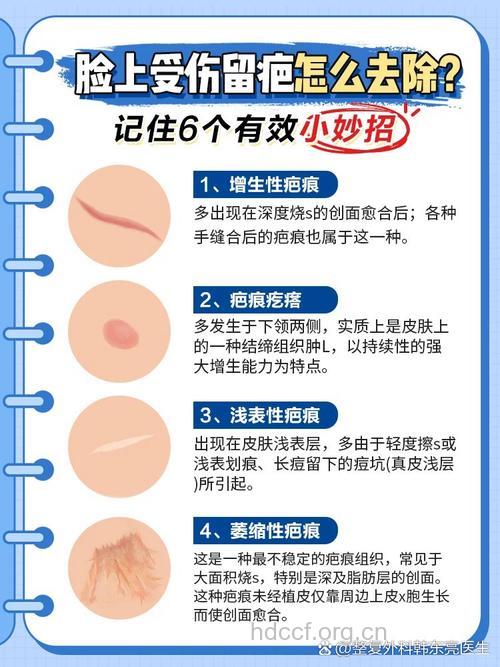 怎么祛除面部疤痕方法
