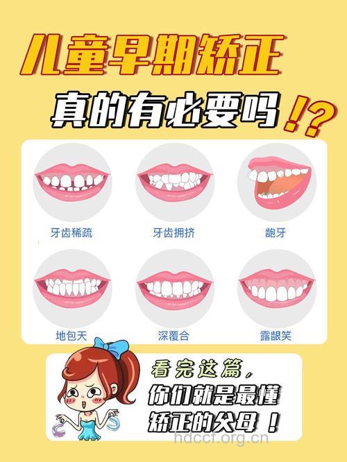 牙齿整形有哪些注意事项