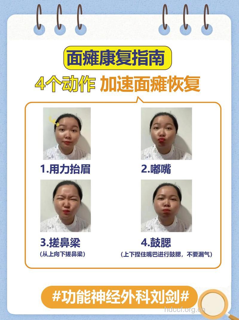 怎样治疗面瘫的问题