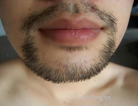 蓄胡须对男性健康有什么影响