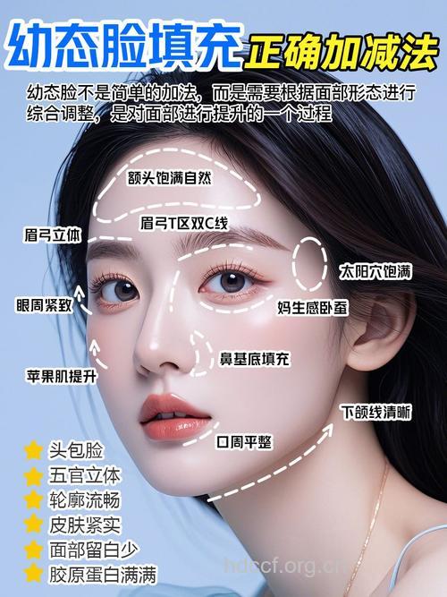 什么是面颊填充术