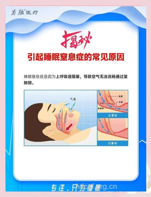 男性朋友为什么会导致睡眠窒息