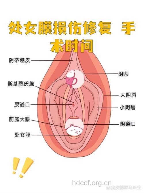 有哪些常见的处女膜修复手术方法