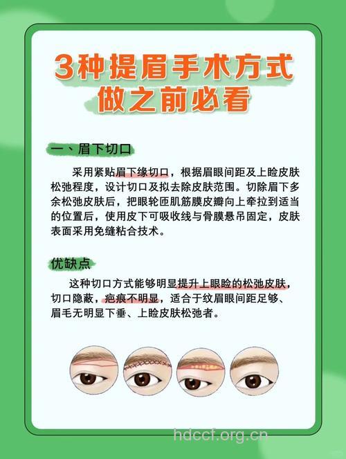 提眉手术有哪些利弊