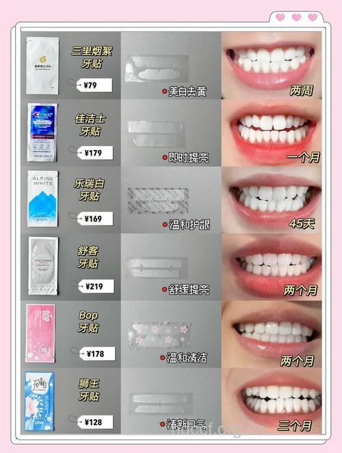 各种美牙的方法及价格
