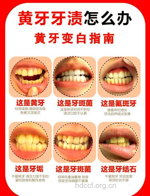 牙齿发黄怎么办?有妙招