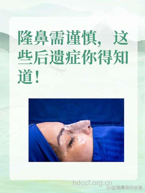隆鼻后出现五种情况要注意