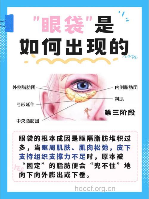 如何处理祛眼袋出现的并发症
