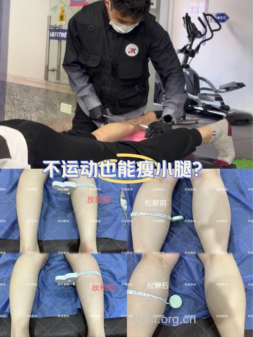 怎么做小腿吸脂手术