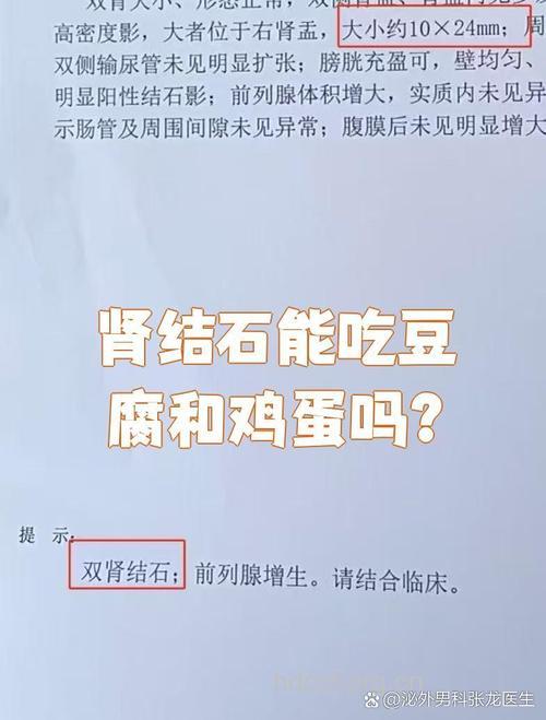 肾结石可以吃蛋吗 吃什么最好