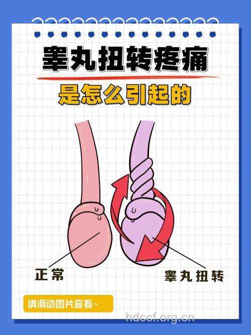 男人“蛋疼”是为何?