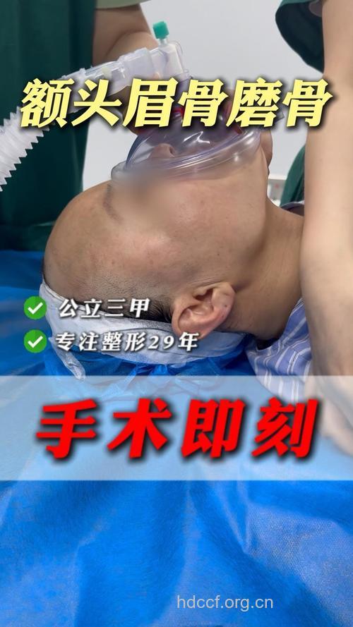 那些人适宜做削骨手术
