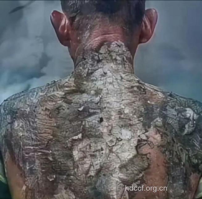 恶习让男人身体很受伤