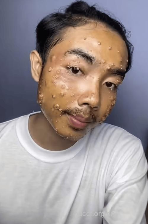 男人有病表现在脸上