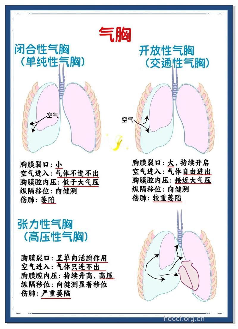 男性为何气胸