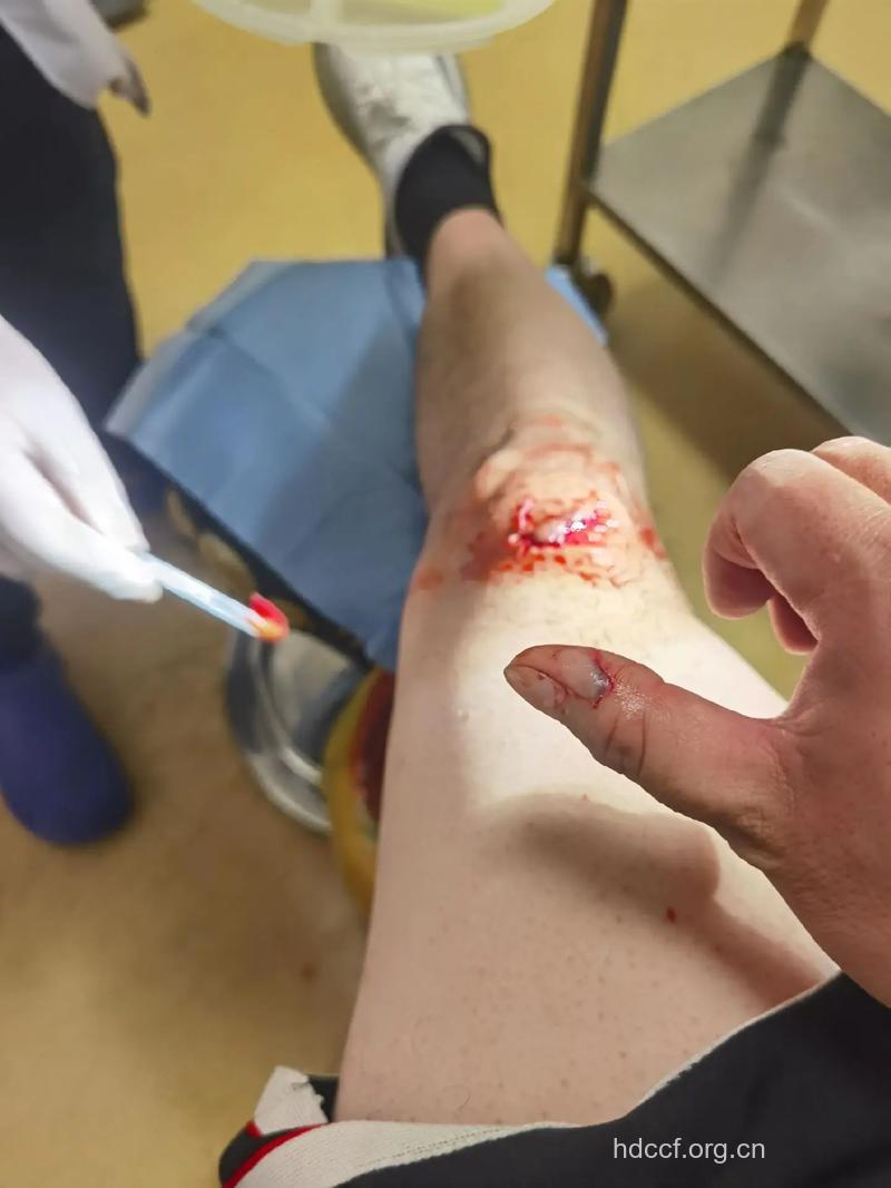 最容易受伤的男性