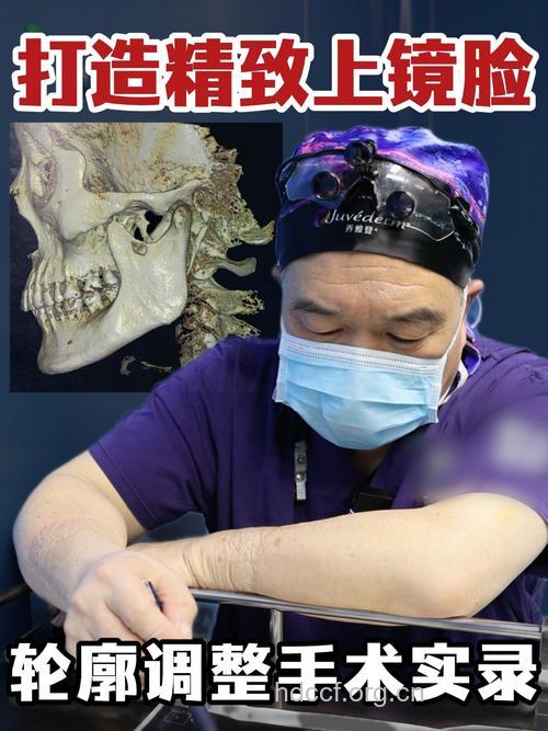 颧骨高如何做手术处理