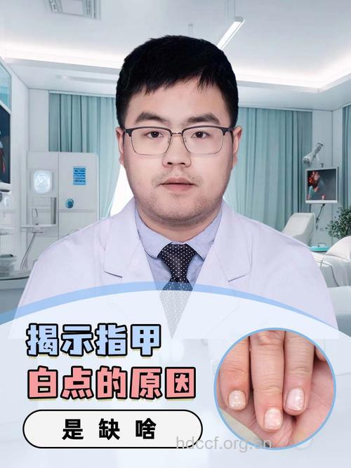 中医说小指有白斑预示肾虚