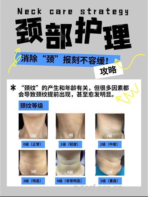 做颈部除皱手术哪些优点?