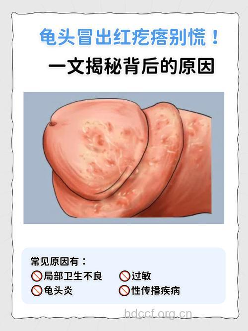 男人清晨显露疾病预兆