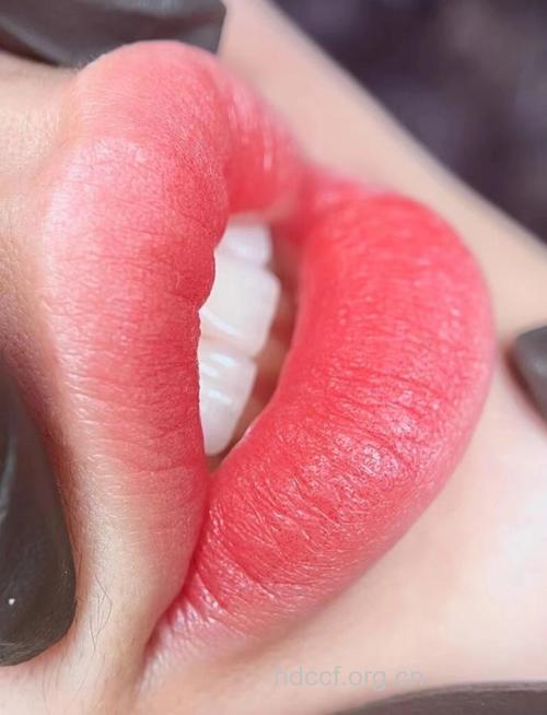 纹唇让你拥有丰满嘴唇