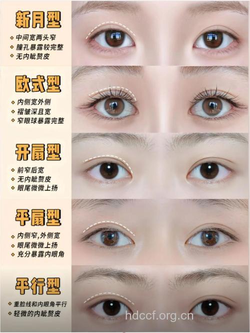 双眼皮的分类 适合中国的女孩的类型