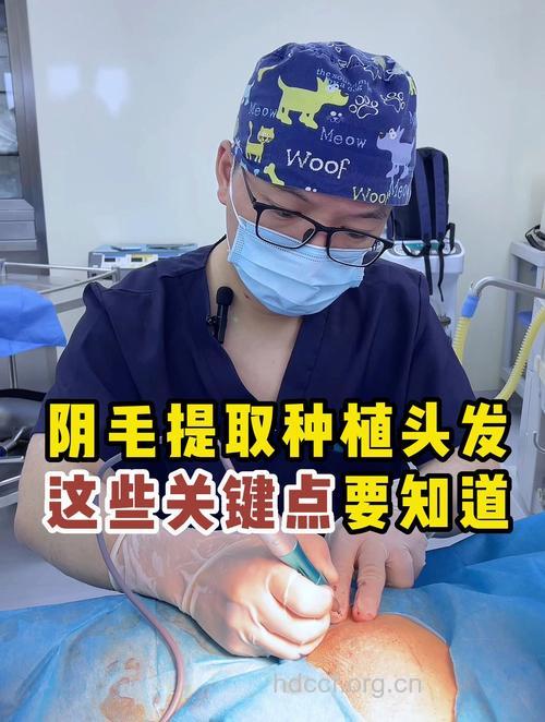 什么是阴毛种植术有哪些方法
