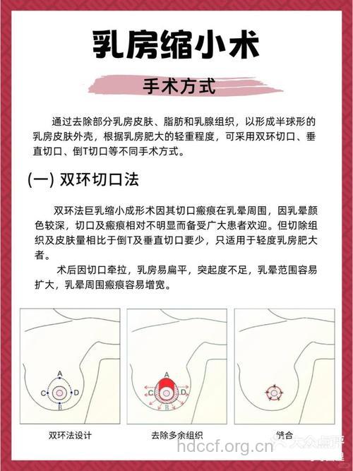 做乳晕缩小手术术前需注意什么