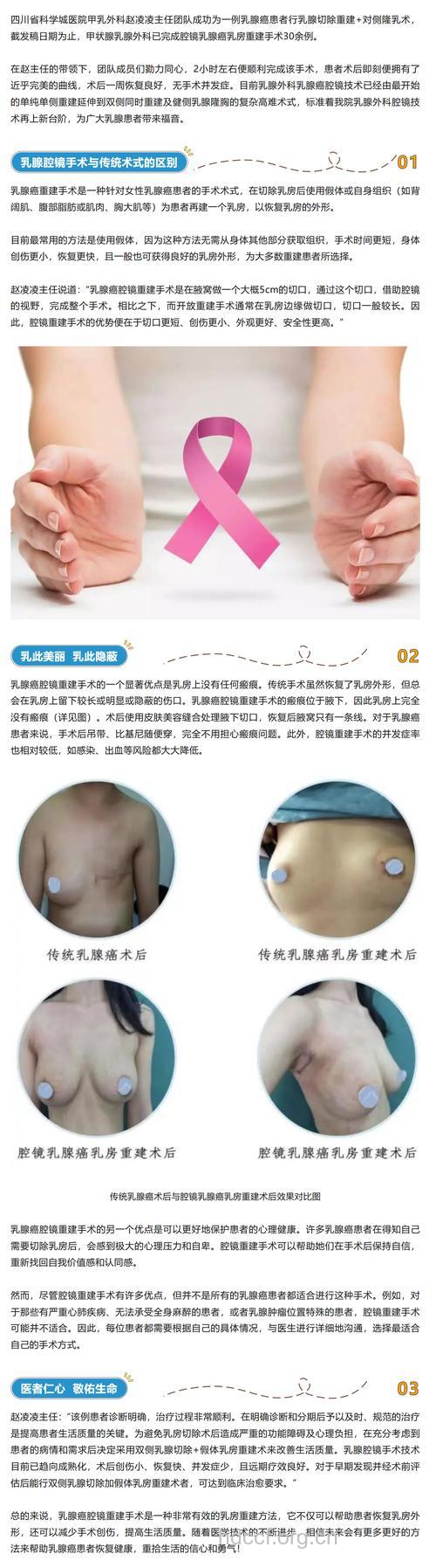 什么是乳房修复再造术